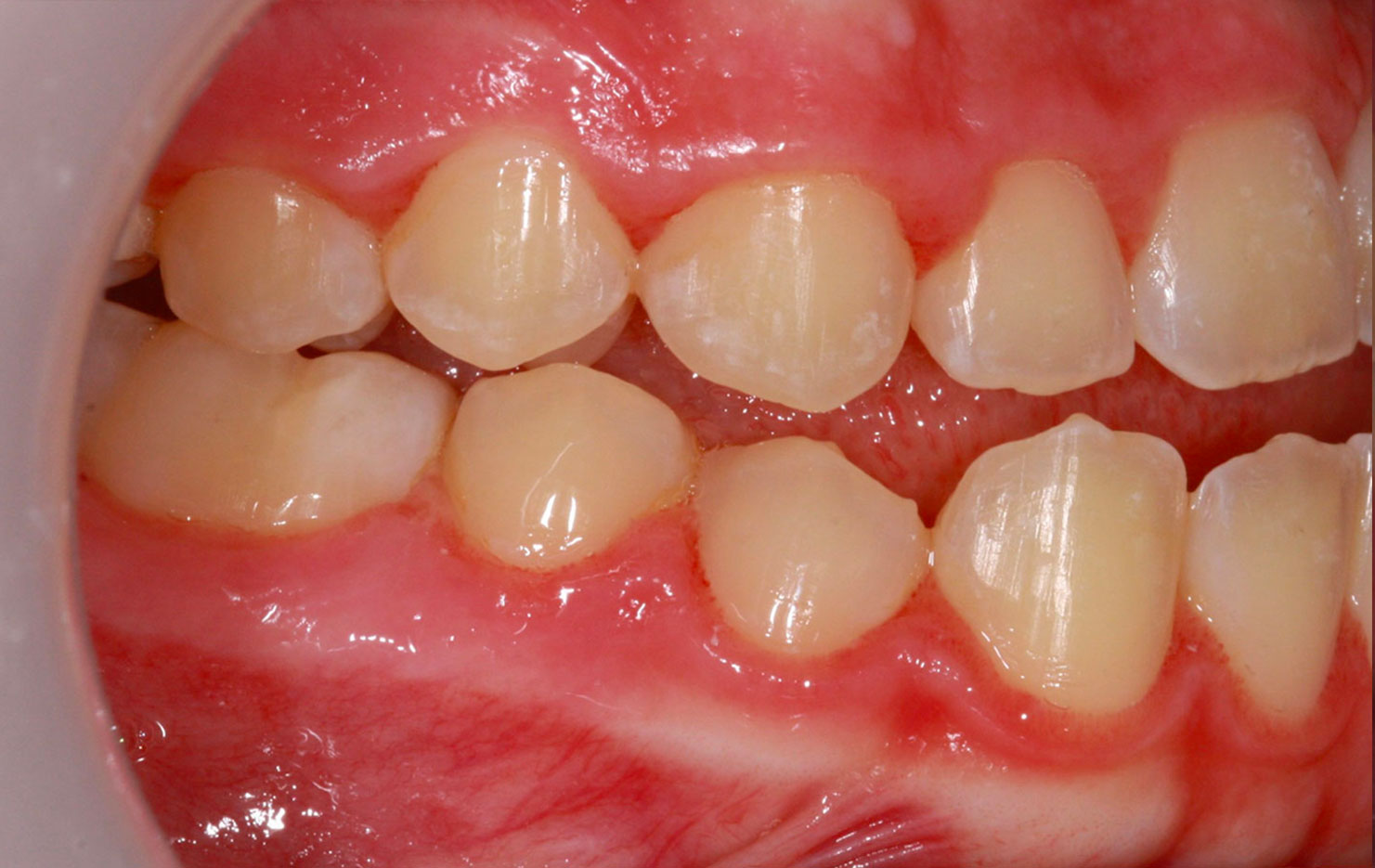 Before image
