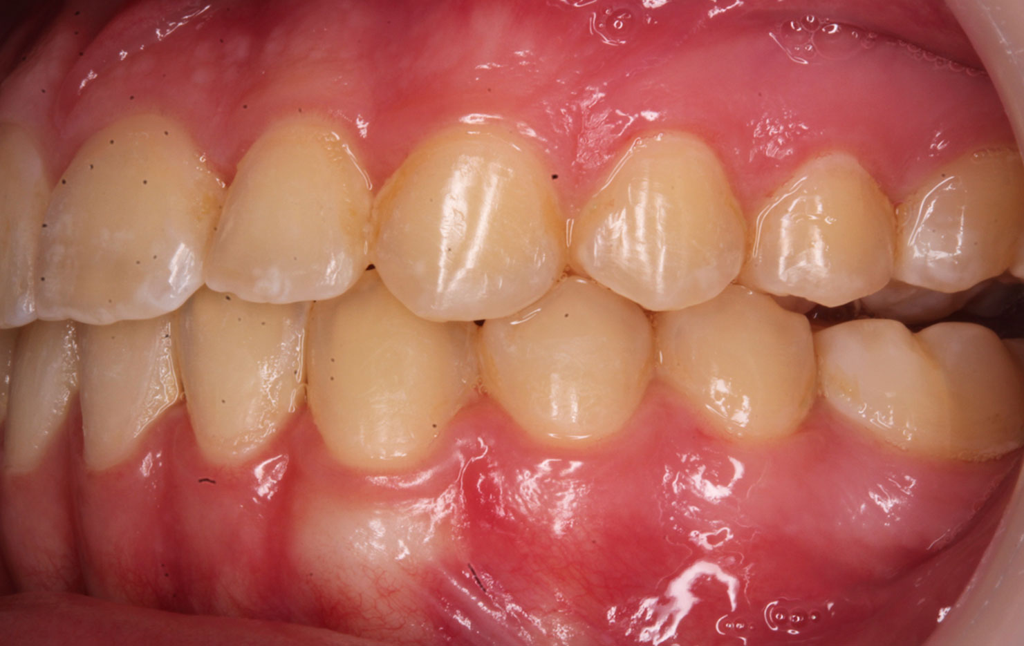 After image