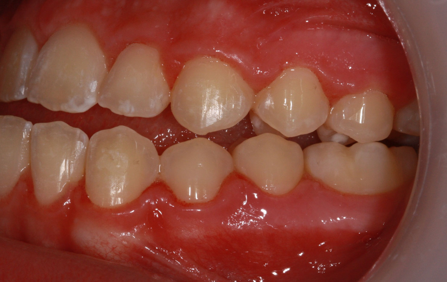 Before image