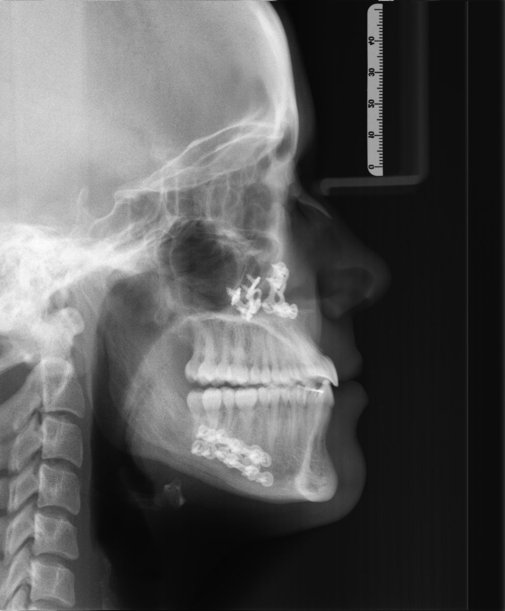 After image