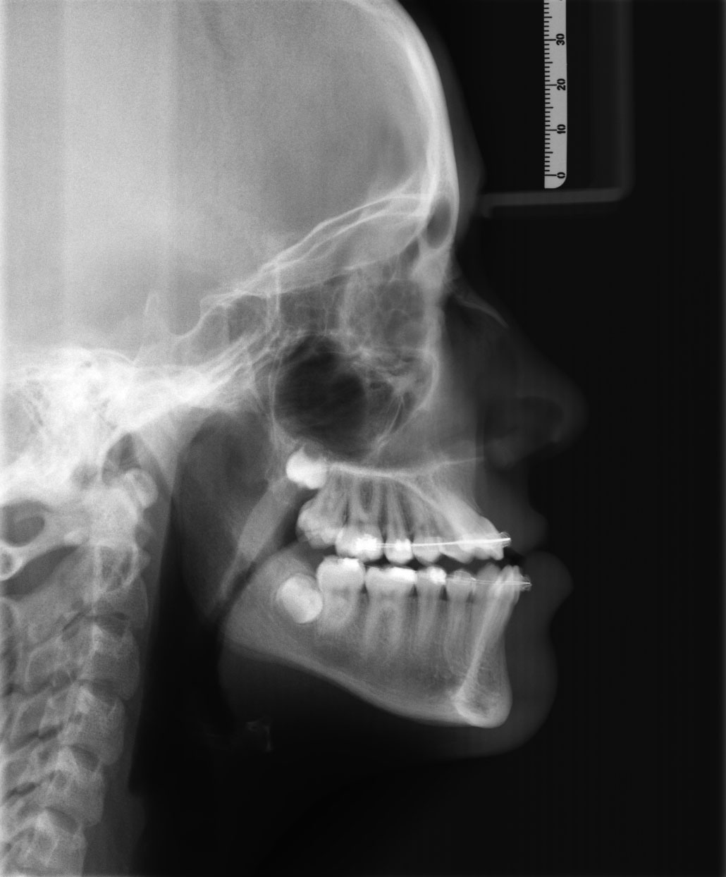 Before image