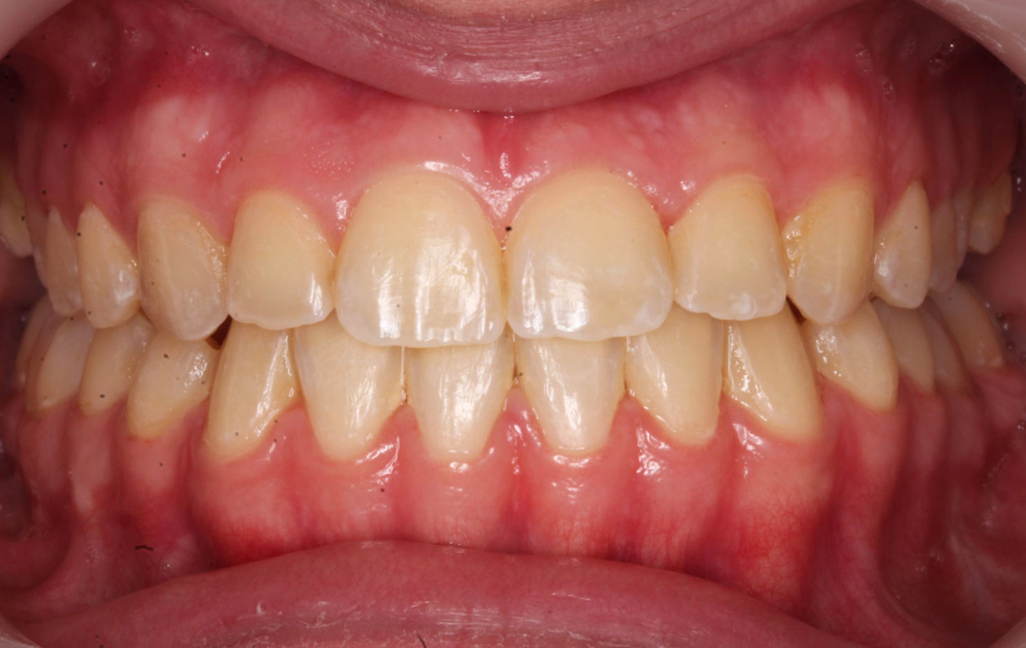 After image