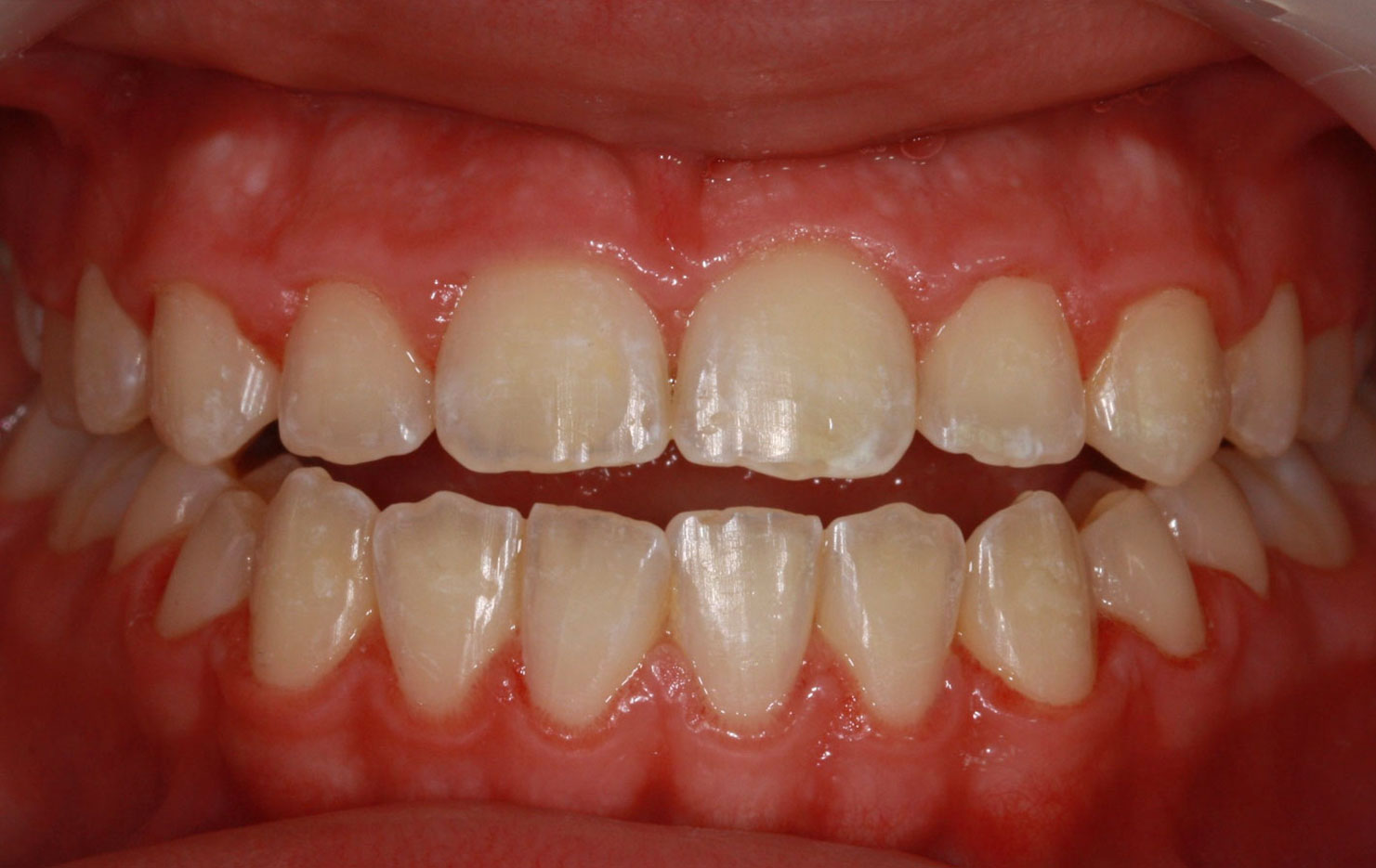 Before image
