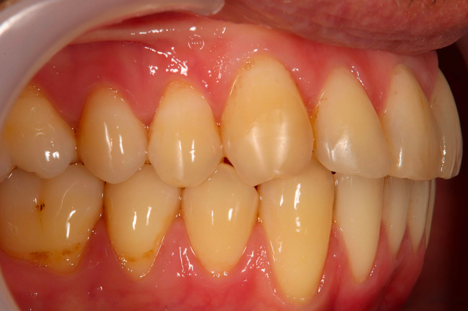 After image