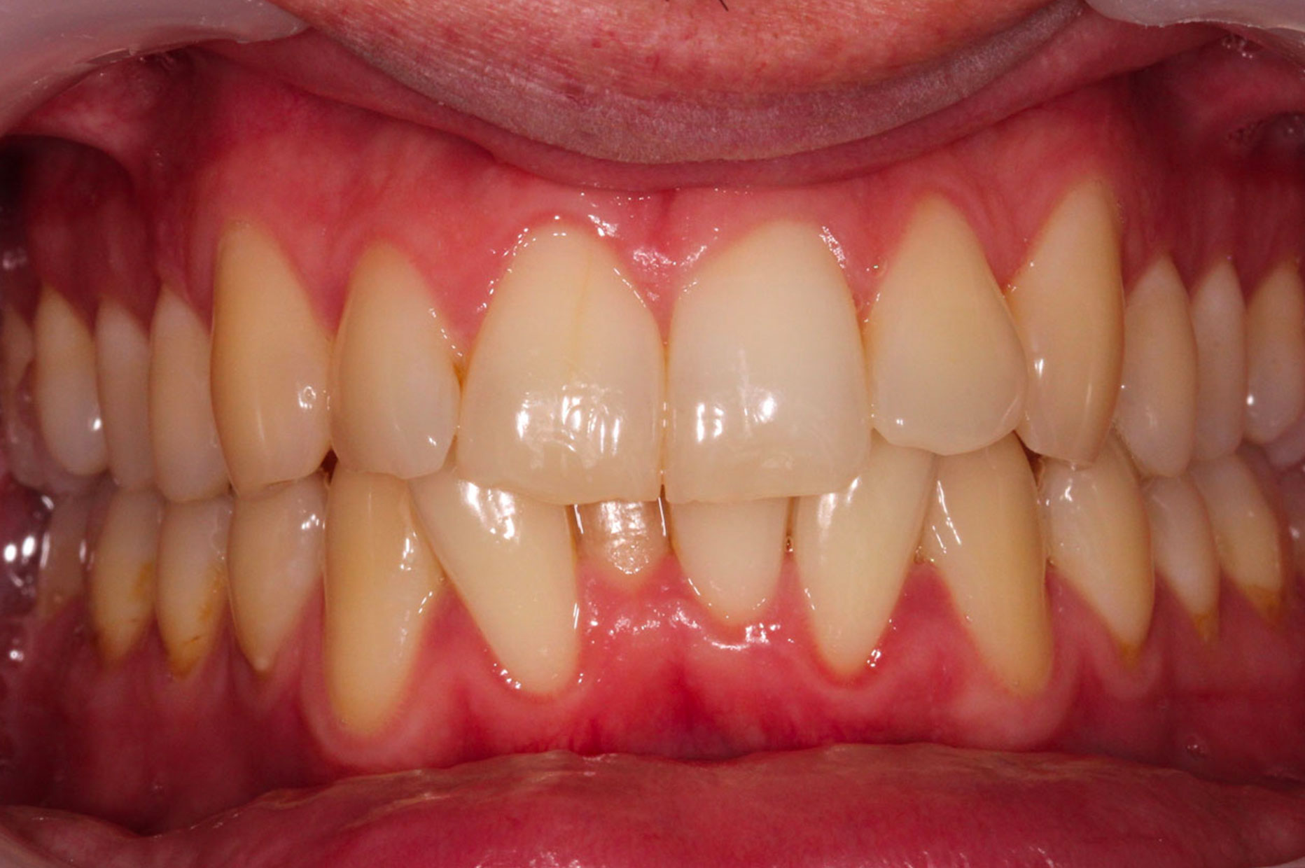 Before image