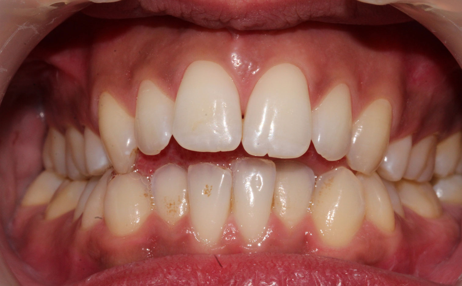 Before image
