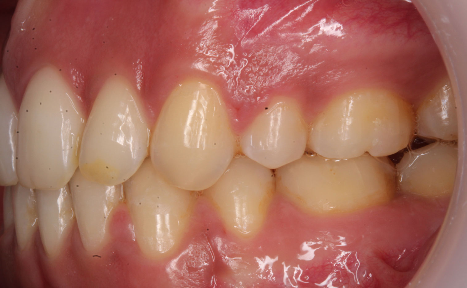 After image