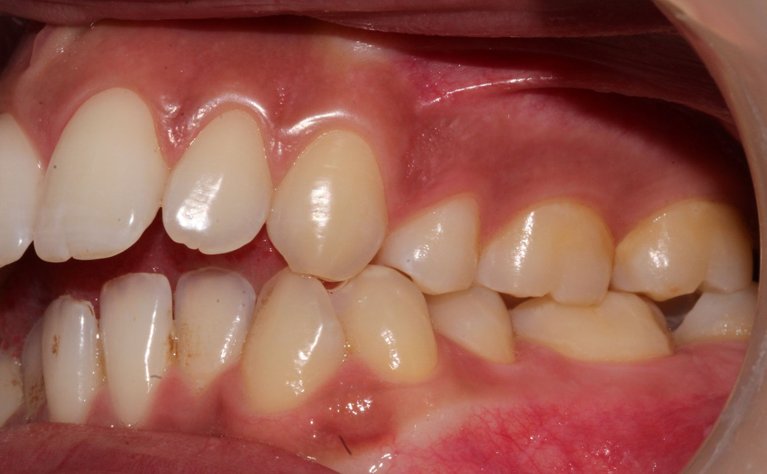Before image