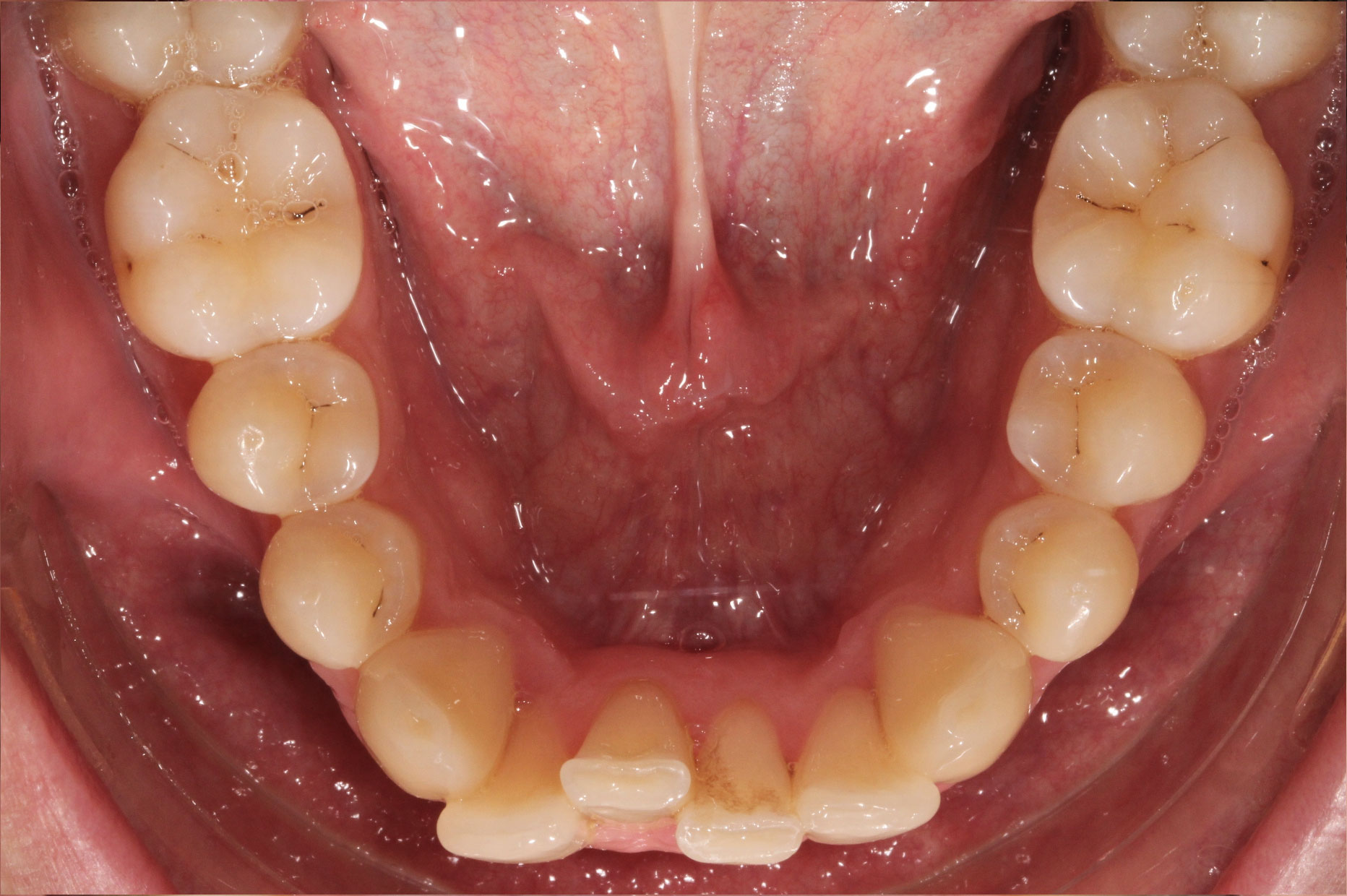 Before image
