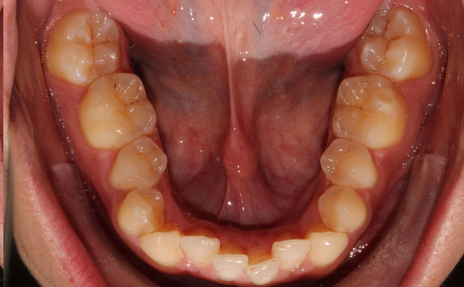 Before image