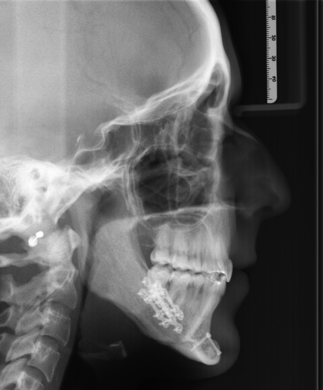 After image