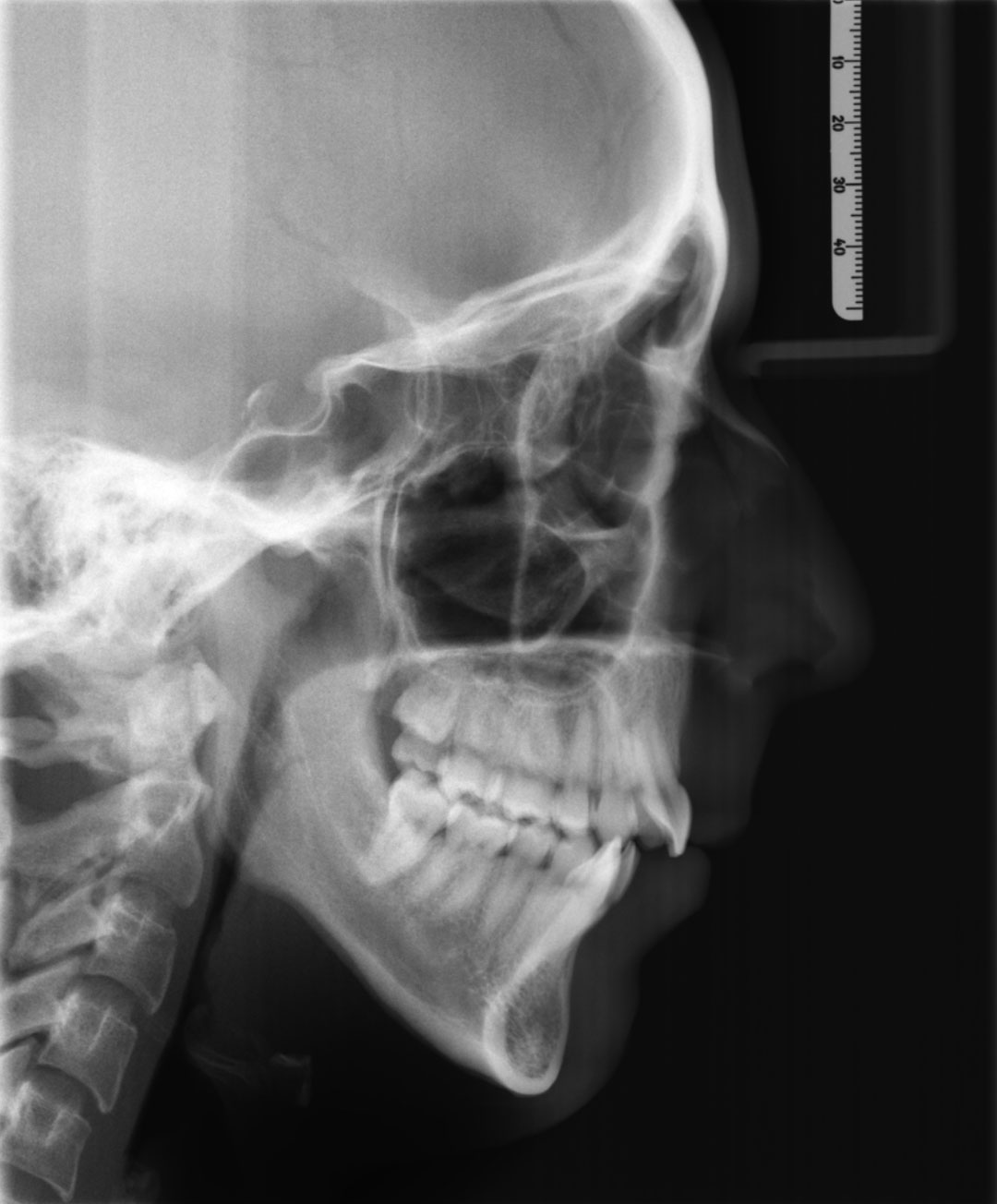 Before image