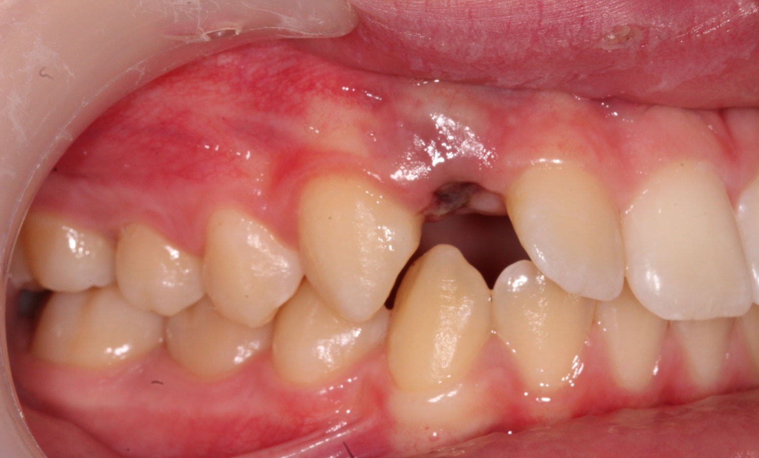 Before image