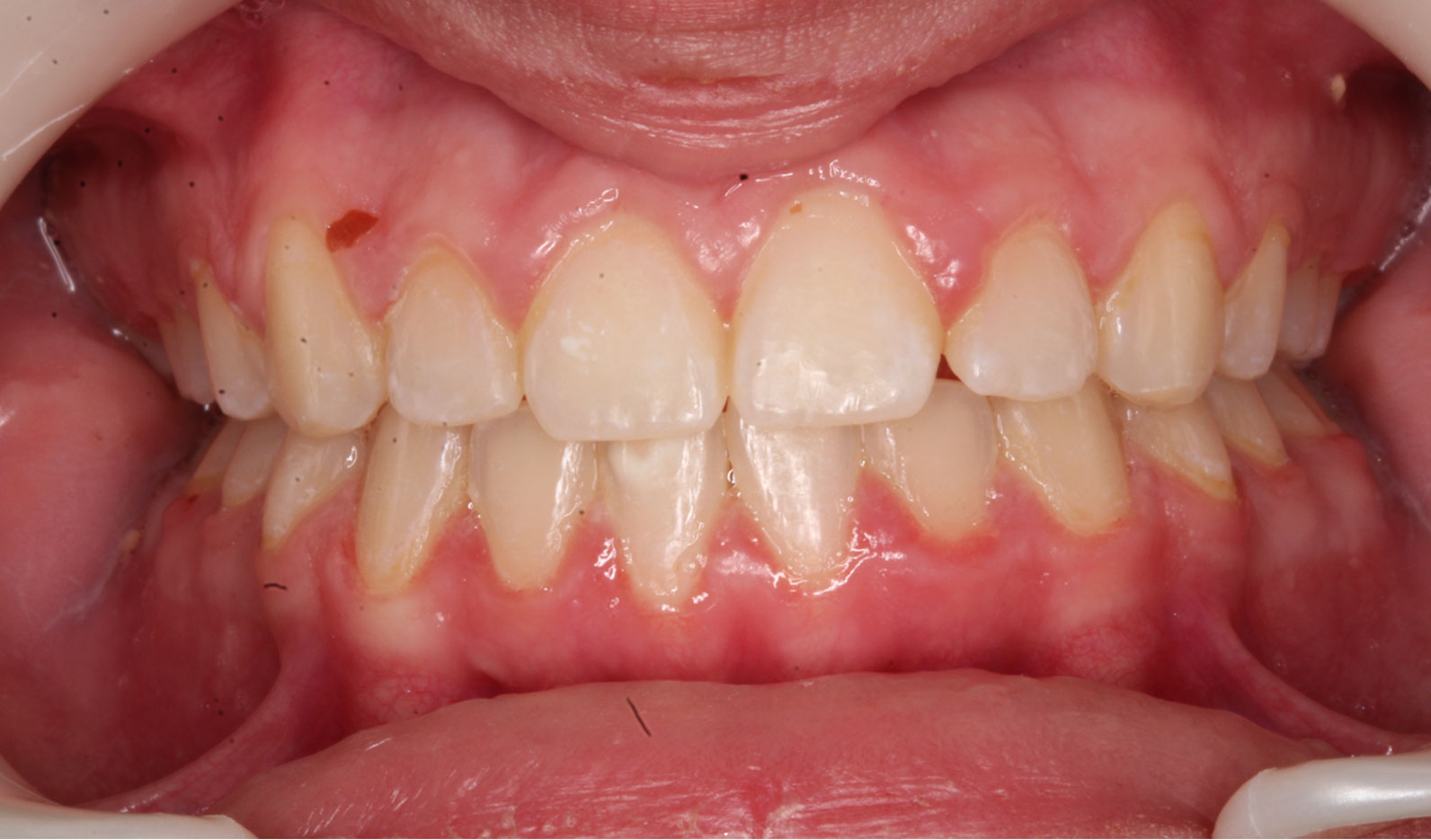 After image