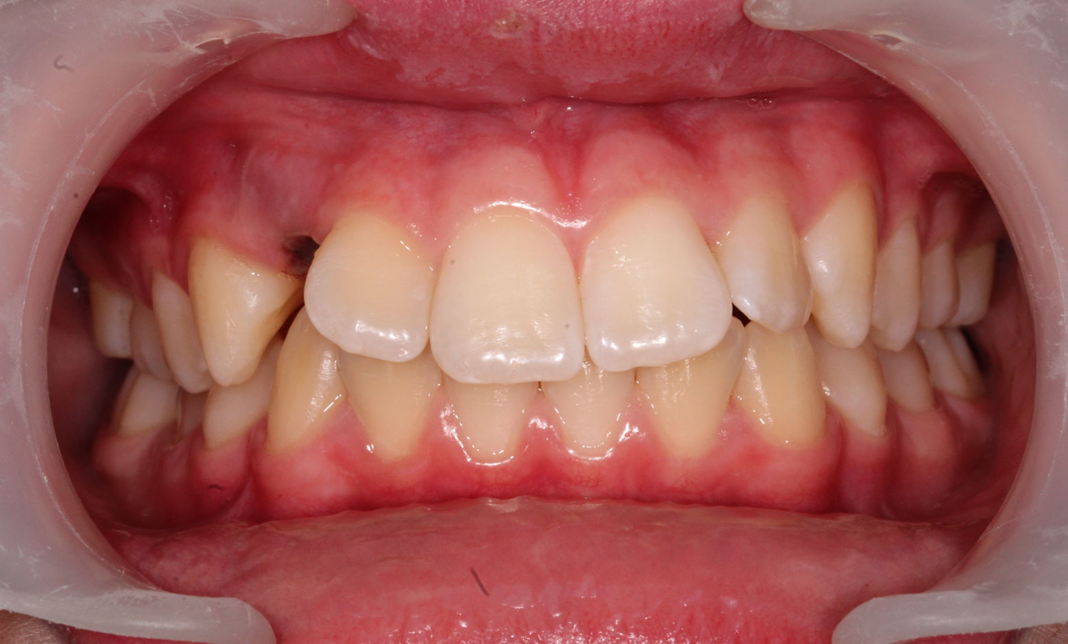 Before image
