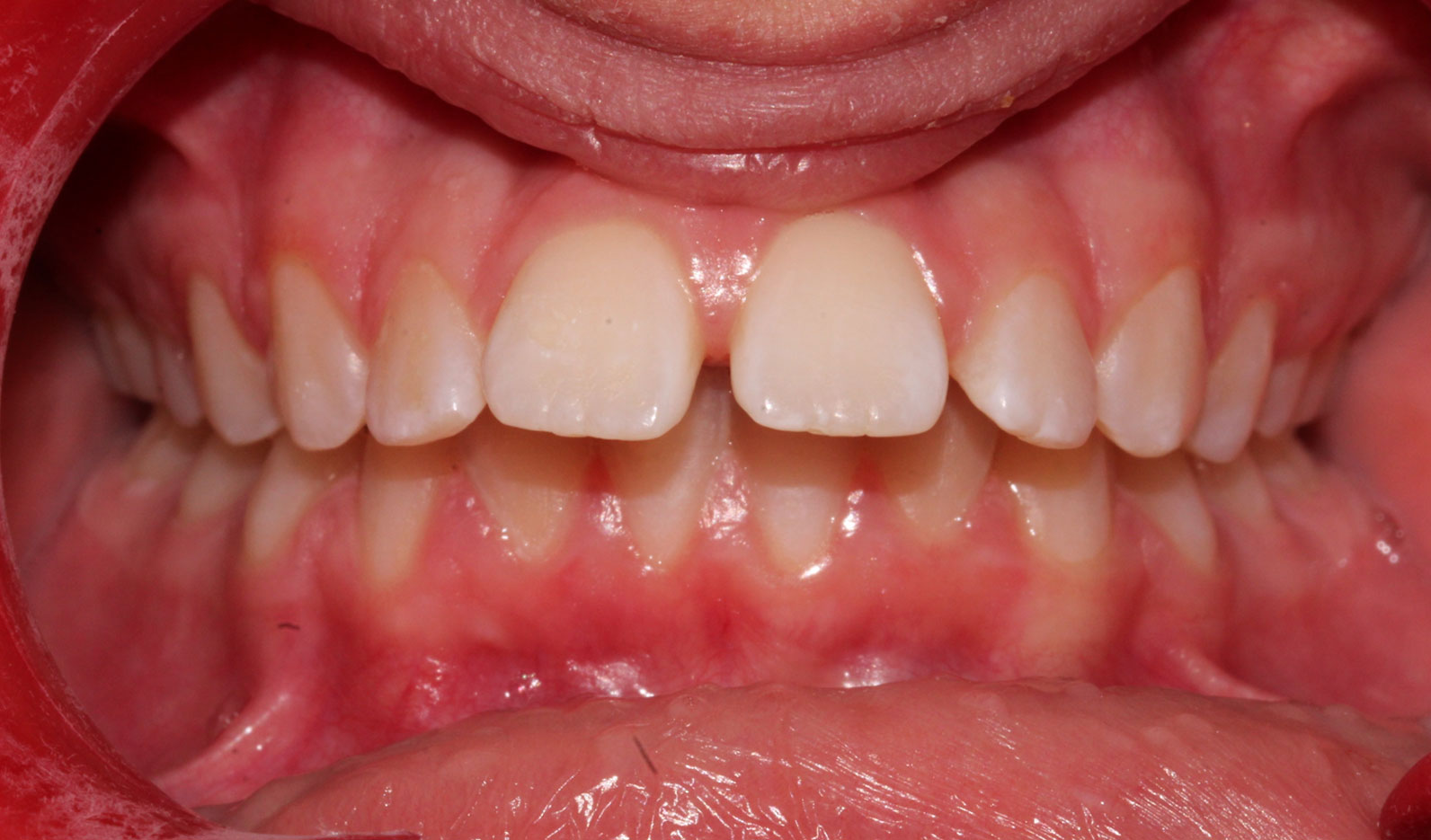 Before image