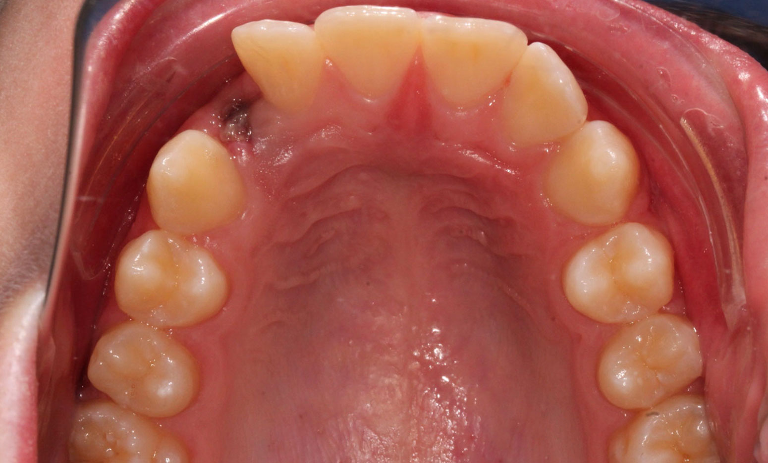 Before image