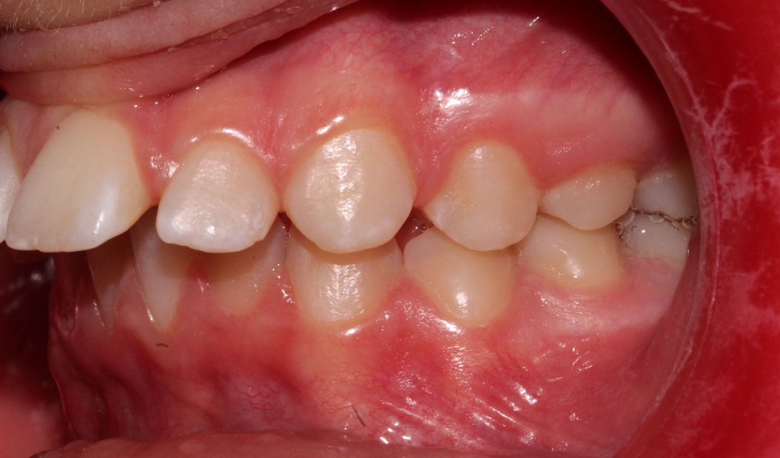 Before image