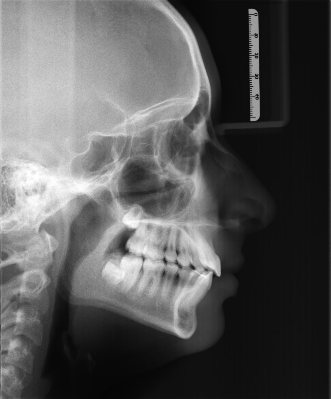 After image