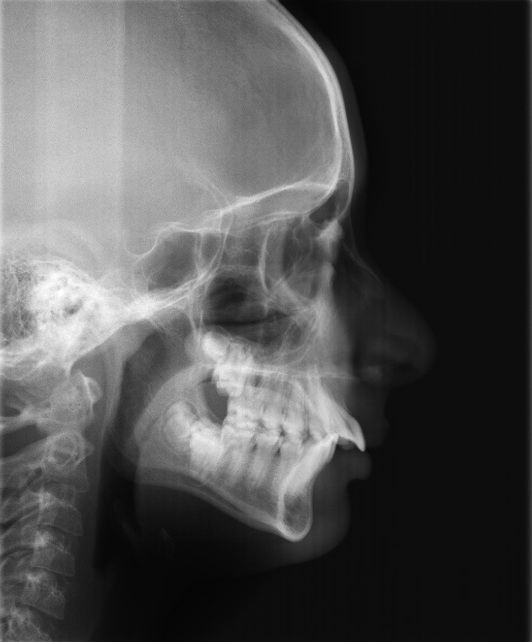 Before image