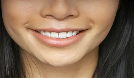 Une jeune femme aux cheveux bruns sourit avec éclat, révélant un sourire radieux et des dents parfaitement alignées